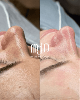 Why OFWs Choose Mold Manila for Safe, Time‑Efficient Aesthetic Care During Philippine Visits